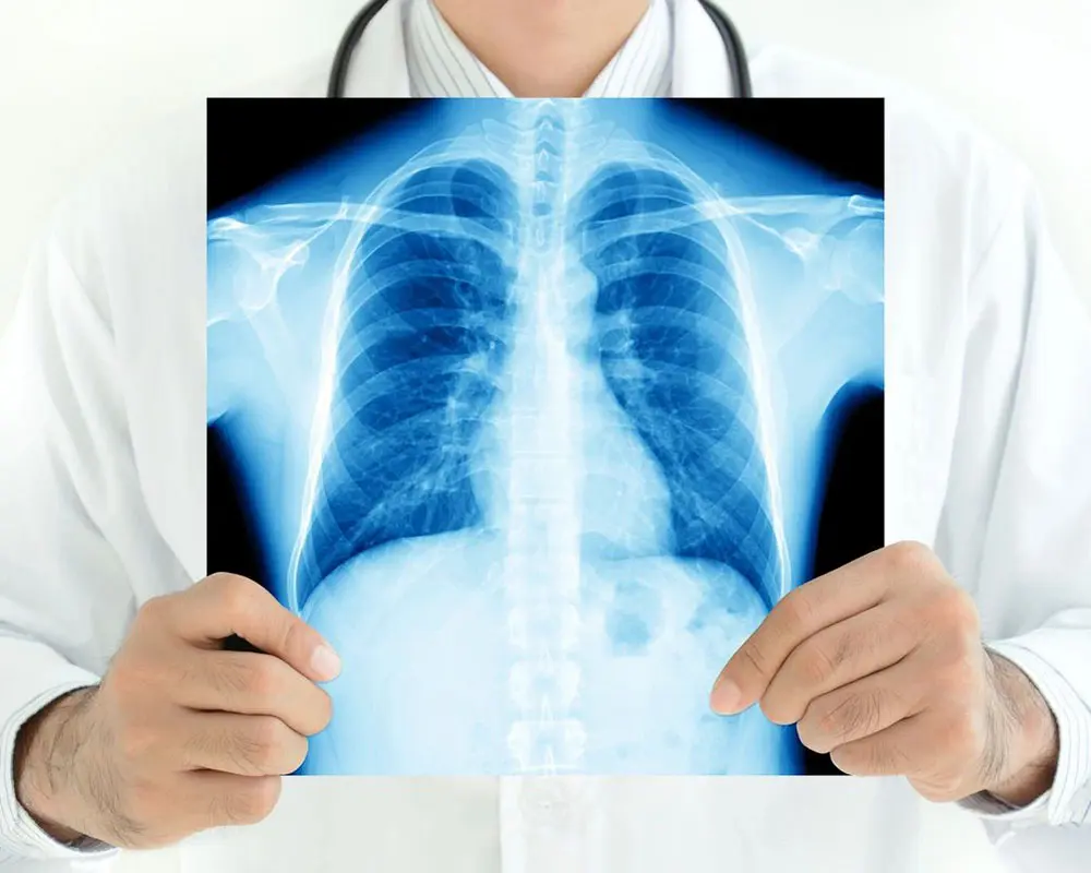 A doctor holding up an x-ray of someone 's chest.