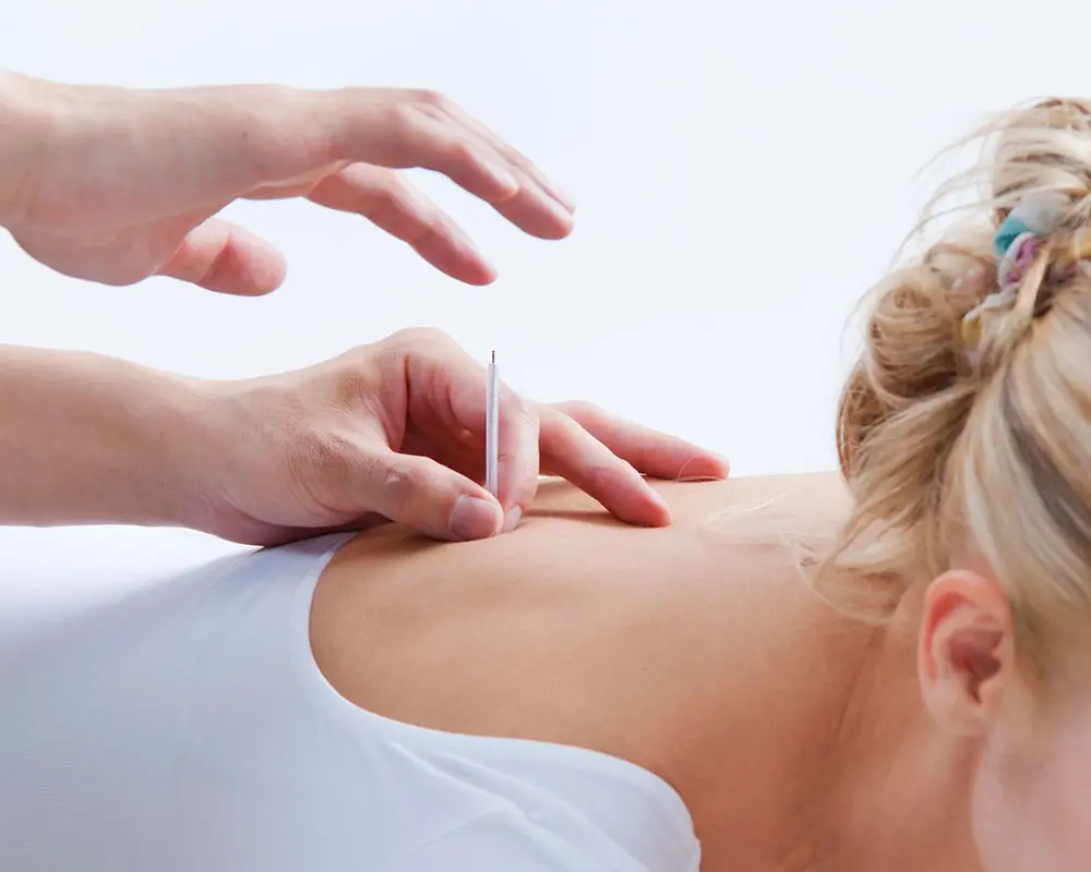 A woman getting her back examined by an acupuncturist.